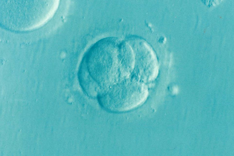 Rekordot jelentő 24 év után született egészség gyermek lefagyasztott embrióból 