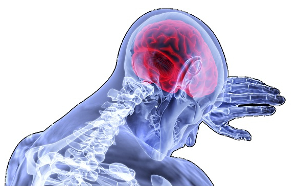Van összefüggés a válás és a stroke kialakulása között